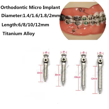 2 ks Zubná Ortodontická Mini Implantát Micro Skrutky Zliatiny Titánu Implantát Skrutkovač, maticový Kľúč Self-Vŕtanie 1.4/1.6/1.8/2.0 mm
