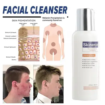 Bielenie Facial Cleanser Jemné Čistenie, Exfoliácia Tvár Odstrániť Melasma Pokožky, Akné Hydratačný Svetlejšie Škvrny Starostlivosti Tmavé W1P6